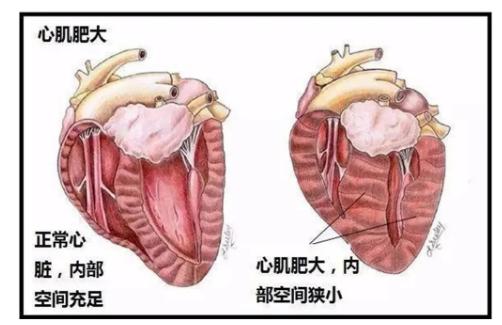 猫跑着跑着突然猝死,猫猝死的症状