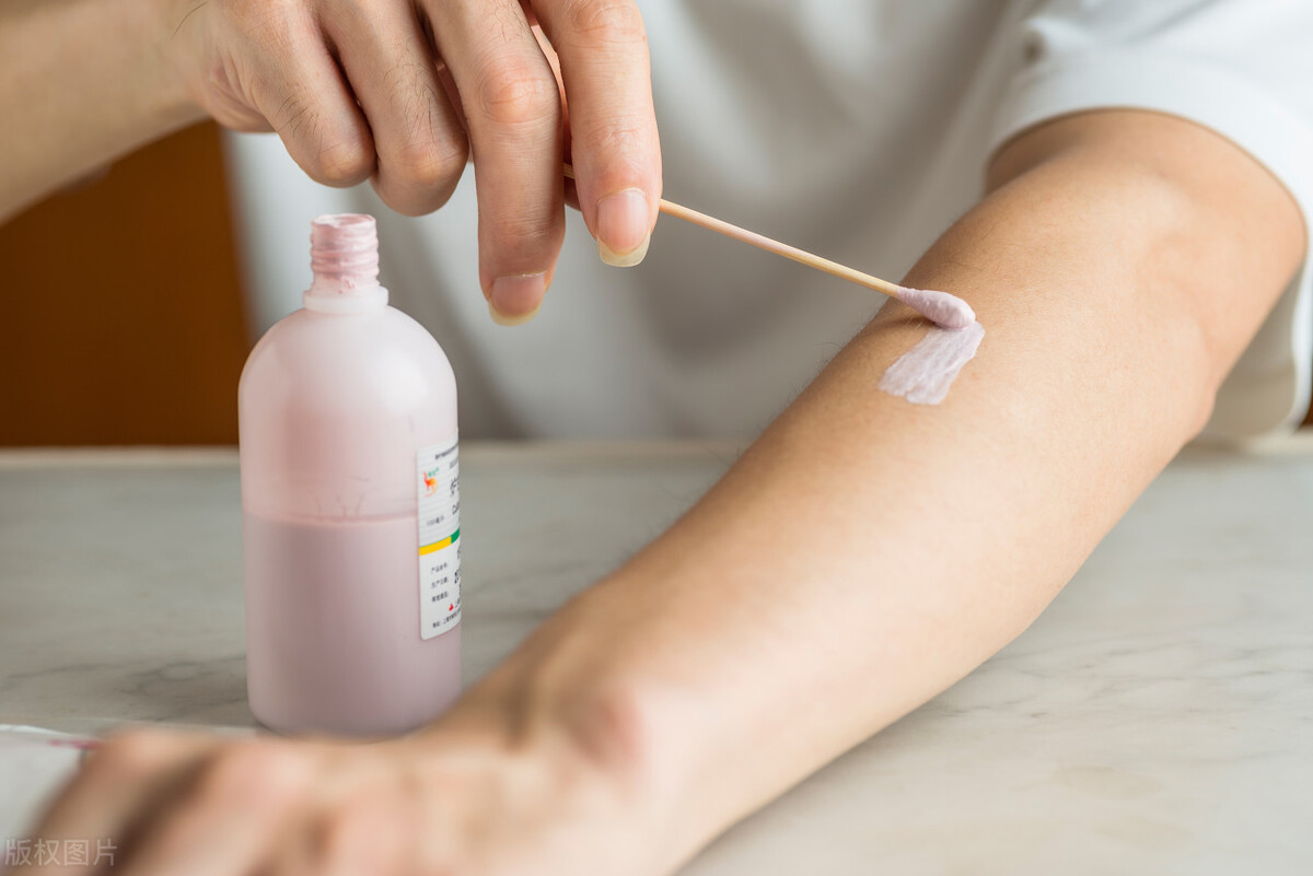 万能炉甘石,炉甘石止痒神器使用方法