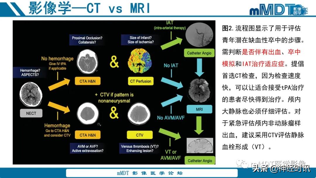缺血性脑卒中护理课件,缺血性脑卒中讲课ppt