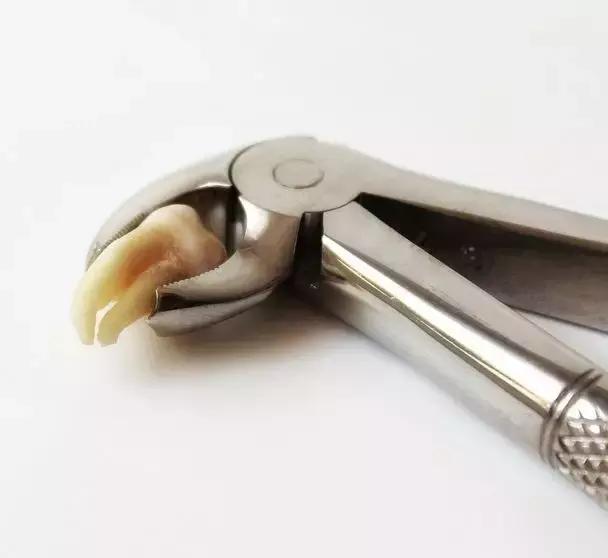 拔完牙窟窿里有食物残渣,拔完牙的窟窿进食物了怎么办