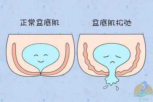 哪些人适合穿塑身衣,长期穿塑身衣对女性造成哪些危害