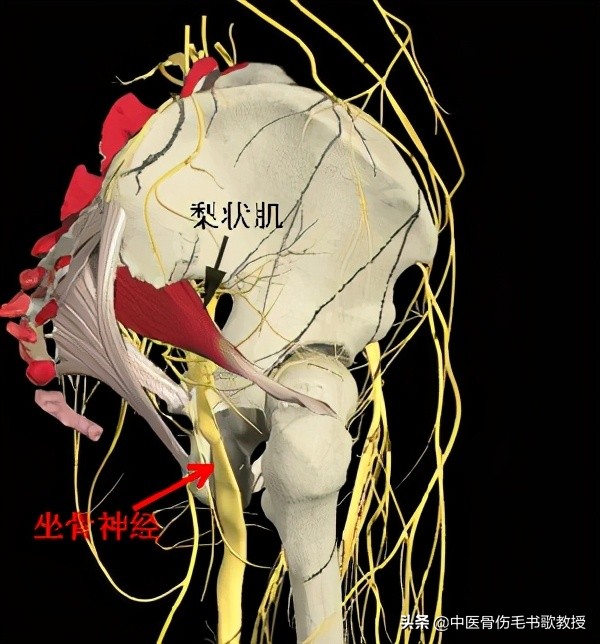 臀部、大腿后侧疼痛,坐骨神经痛,必备两种拉伸法,有效缓解疼痛