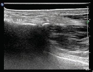 玩手机玩到疯,玩手机玩多了食指疼