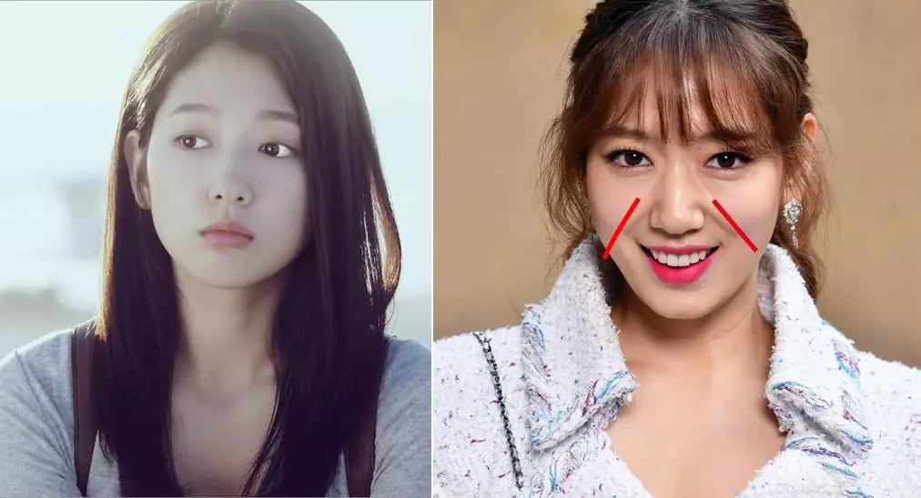 一招帮你搞定淡化法令纹,教你一招二天消除法令纹