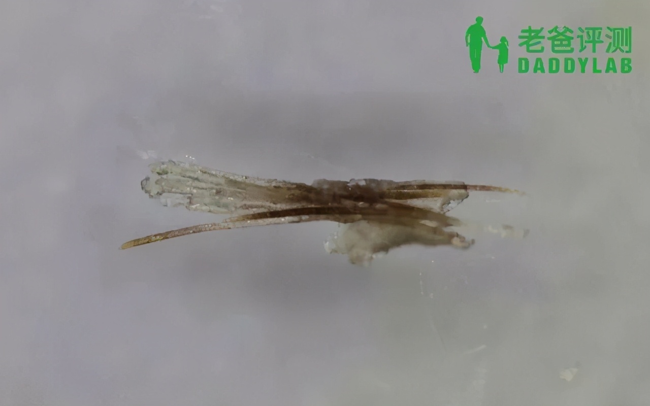 黑头怎么从根部去除,黑头到底怎么去