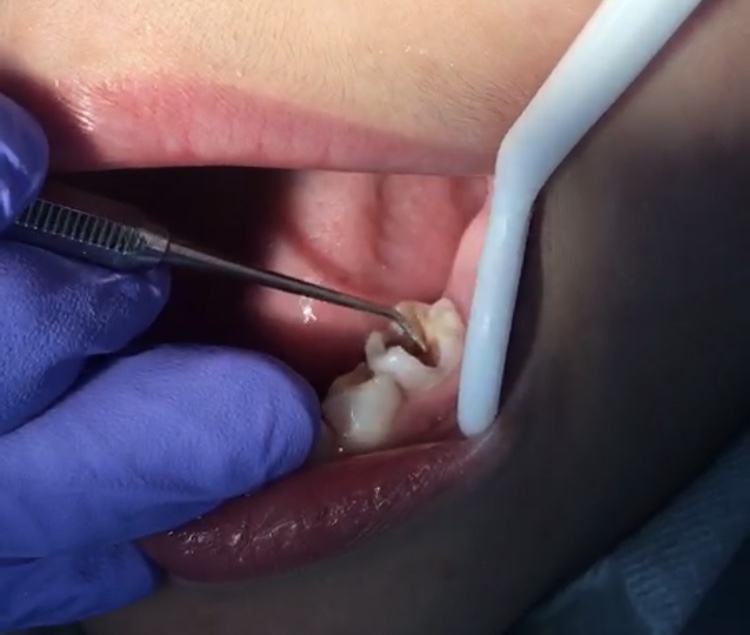 孩子不愿意刷牙？除了恐吓逼迫，全家人统一战线“玩起来”更重要