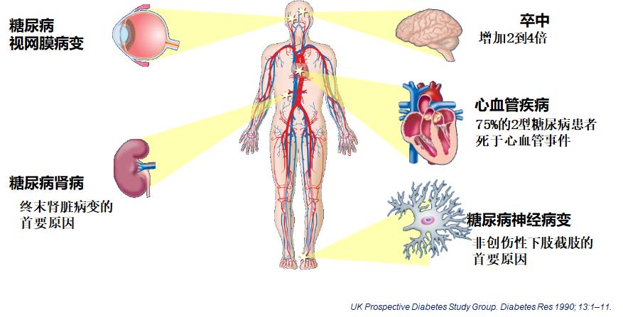 糖尿病患者怎么吃口诀教给您,糖尿病人应该怎么吃人参