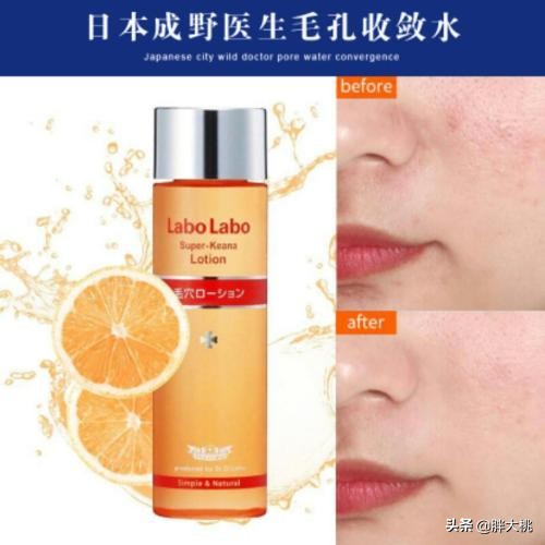 城野毛孔收敛水怎么样,城野医生收缩毛孔水有没有用