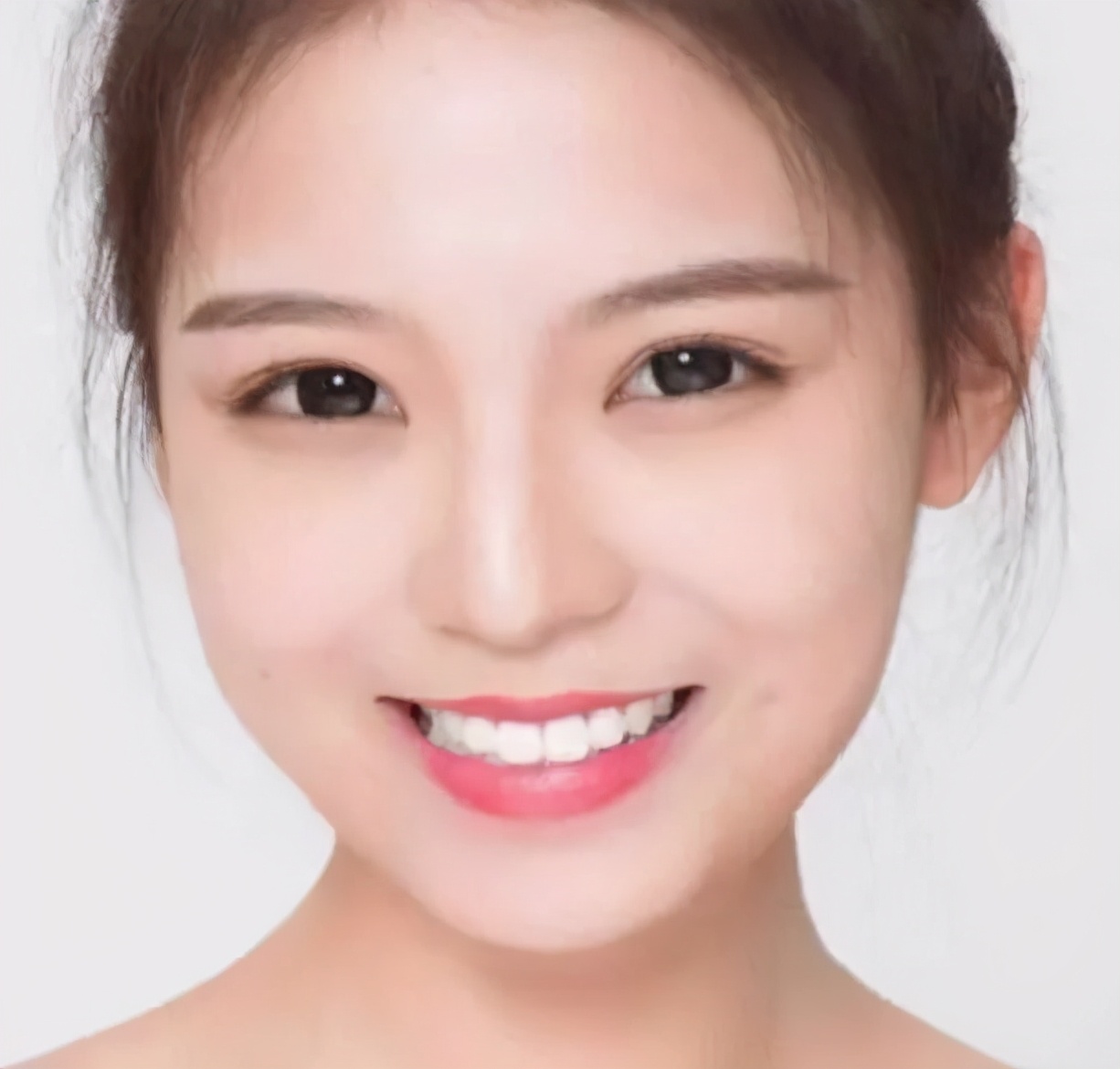 面部显老憔悴怎么办,显老显丧的面颊凹陷应该如何改善