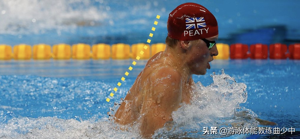 医生说游泳可以治疗颈椎病？——没错，可是为健康还要注意这两点