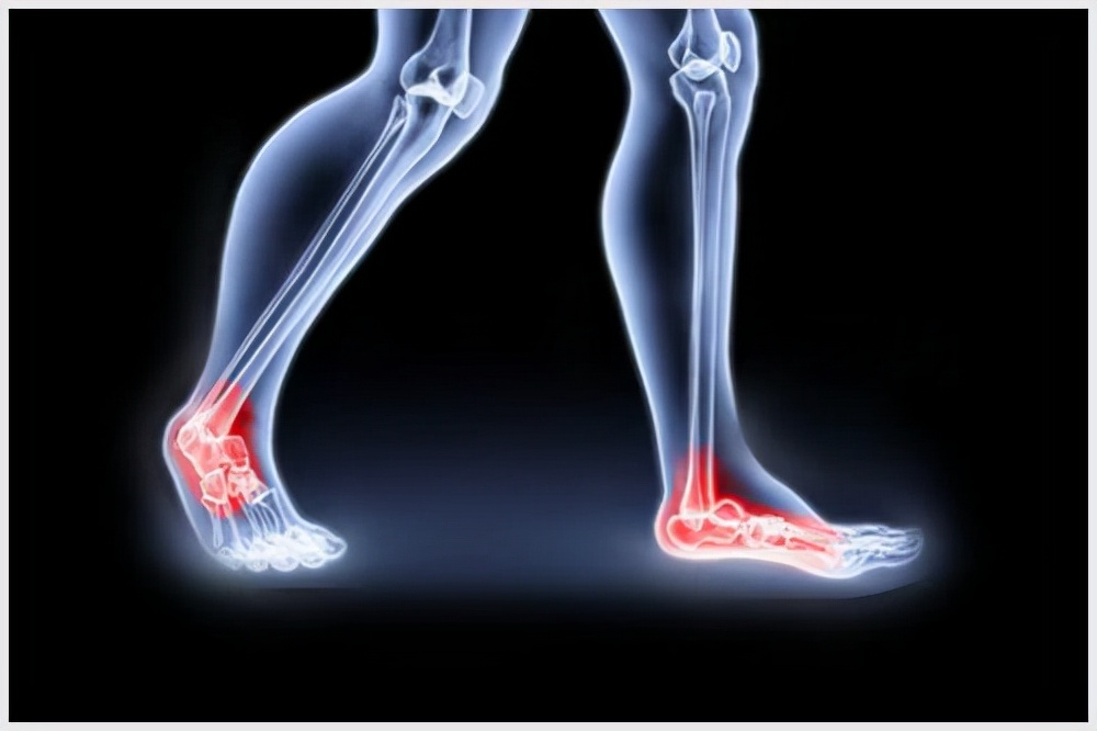 痛风的症状是从脚开始的吗,痛风左右脚轮流发作解决办法