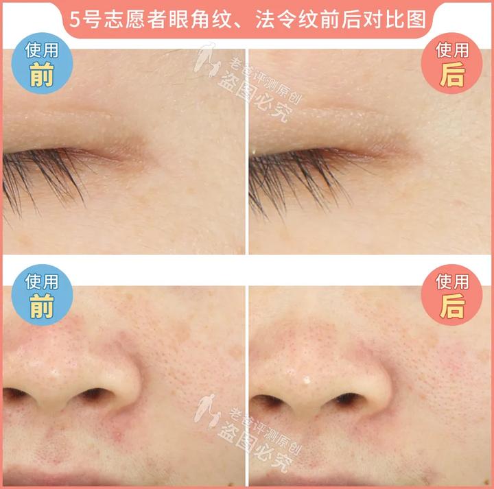 300块的网红美容仪有效果吗,网红家用美容仪测评