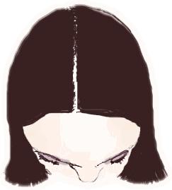 甲亢案例,甲亢治愈后眼球突自救方法