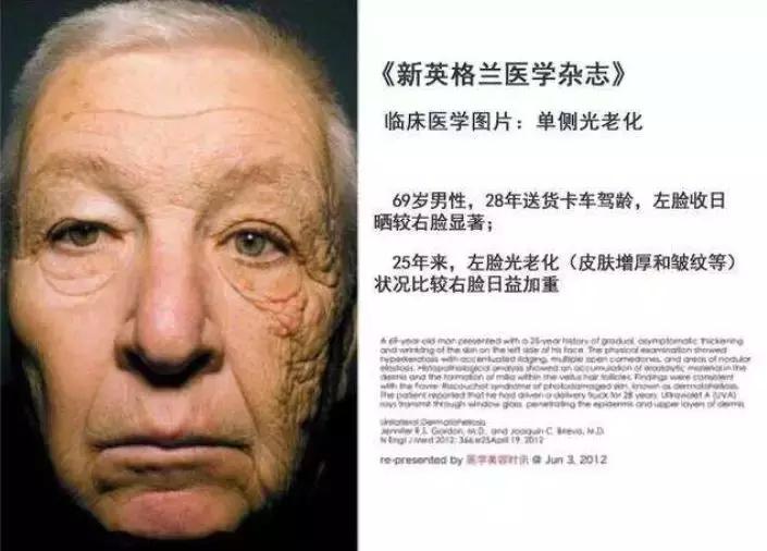 甜馨怎么这么白了,甜馨为啥那么黑