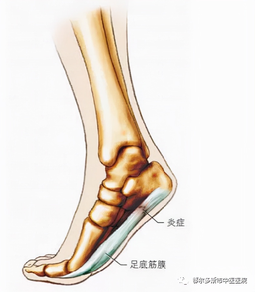 小儿髋关节发育不良都做什么检查,小儿髋关节发育不良超声