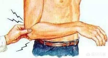 胳膊肘疼俗称网球肘怎么止痛,胳膊肘筋疼不敢伸直挂什么科