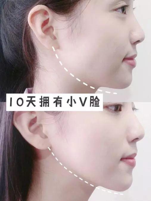 屈臣氏的“王炸”面膜,薇娅、宋祖儿都在用,一拉一提拥有小v脸