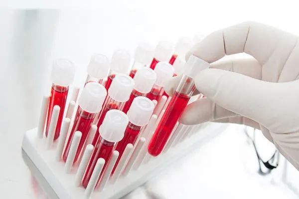 肾病能得到彻底“治愈”吗?请把握住这两个关键时期