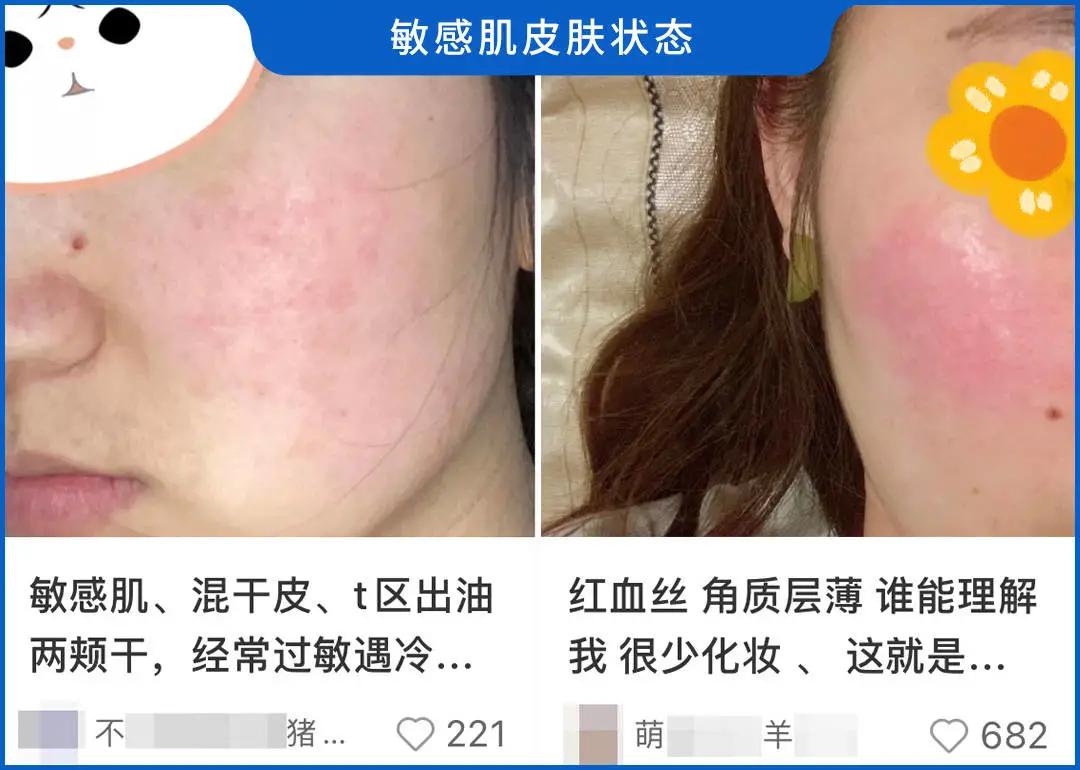 90%的肌肤问题都是皮肤缺水,100个皮肤问题