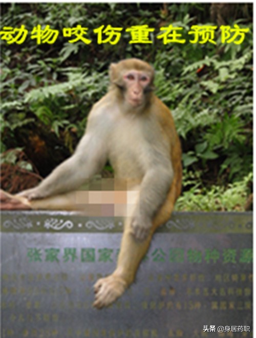 不幸被动物咬伤自救,人被动物咬伤后怎样处理