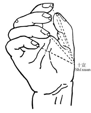 小孩扁桃体发炎推哪个穴位,小孩扁桃体炎吃什么药效果最好