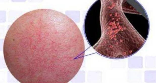 敏感肌到底可不可以刷酸,敏感肌肤可以刷酸的产品