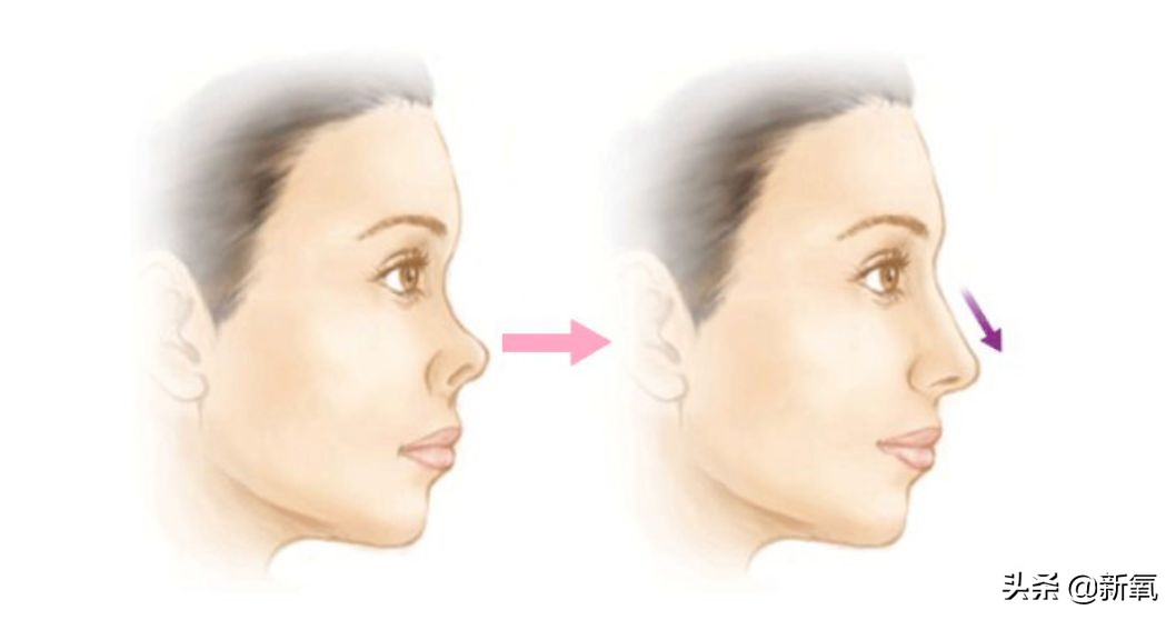 十元应该是娱乐圈唯一上传做作假哭照，还被夸奖可爱的女明星了