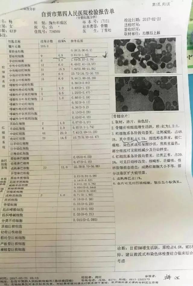 骨髓涂片中幼粒细胞17%是什么原因,骨髓涂片原始粒细胞正常值是多少