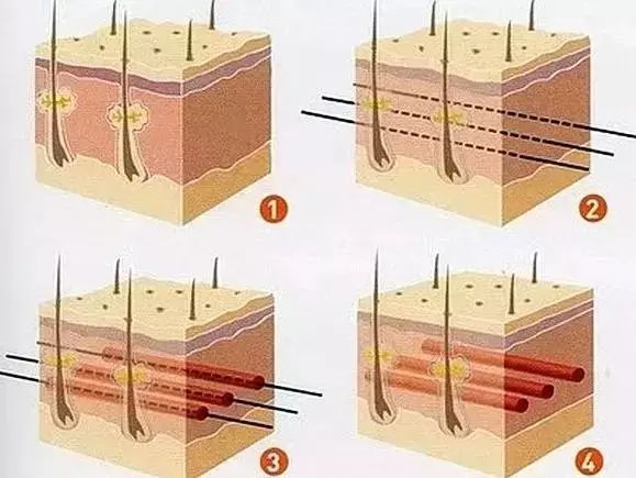 王祖贤到底有没有整容,王祖贤整容成功了吗