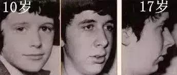 治疗鼻炎的关键就是把痰排出去,中医治疗鼻炎鼻腔有痰