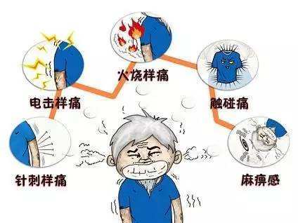 牙疼要先治牙神经才能拔牙吗,三叉神经痛引起的牙痛可以拔牙吗