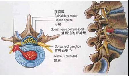 生物制剂治疗强直性脊柱炎的效果,强直性脊柱炎引起胸口疼如何治疗