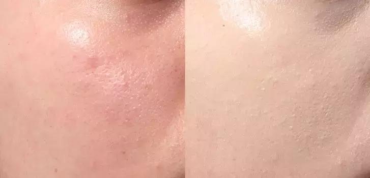 平价好用的气垫推荐采访,平价好用的气垫测评无广告