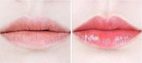 黑三角如何护理,年轻人三角眼面相