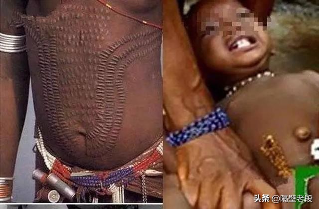 熨平少女胸部！揭秘非洲可怕习俗“烫乳”