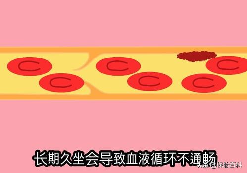 久坐对女性盆腔的影响,上班经常久坐如何预防疾病