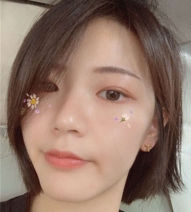 脸上长闭口粉刺怎么办,脸上长了闭口粉刺怎么解决