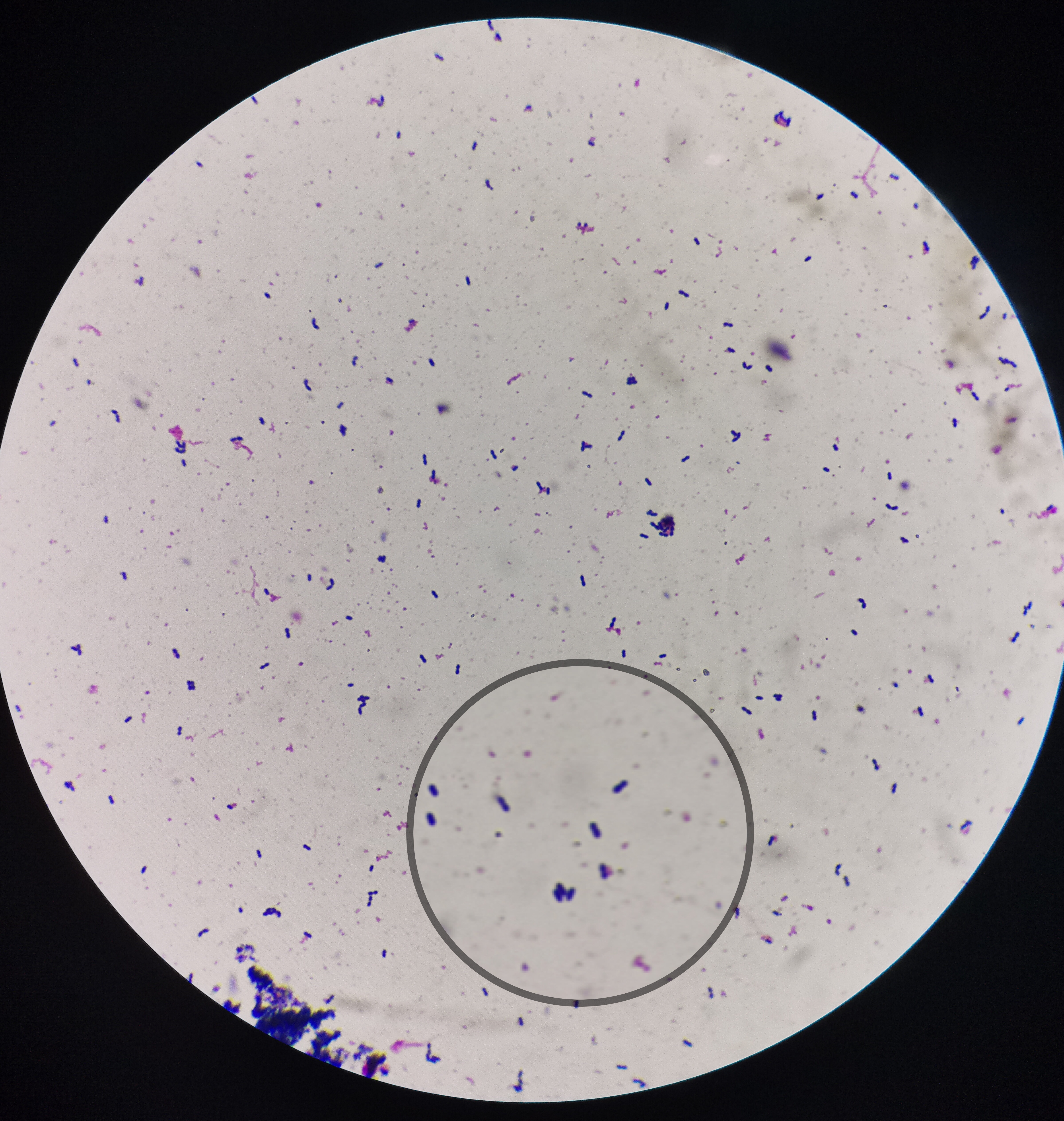 猪肉携带有病菌？感染到人体怎么办？预防措施要做好