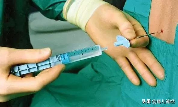 顺产撕裂与侧切有什么区别,顺产撕裂和侧切的区别是什么