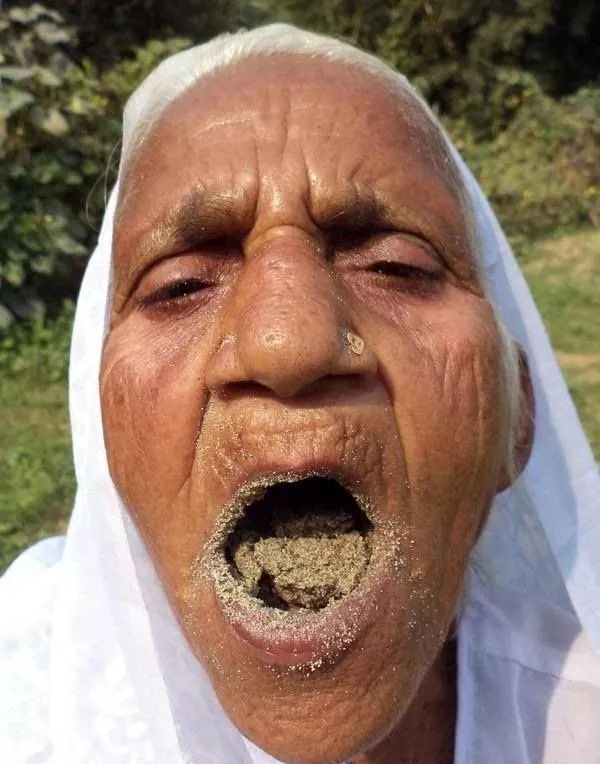 嗜痂之癖是什么心理疾病,十宗罪里的嗜痂之癖的由来