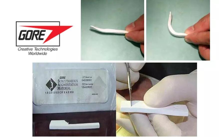 鼻子变好看的方法真正有用,鼻子如何才能变漂亮