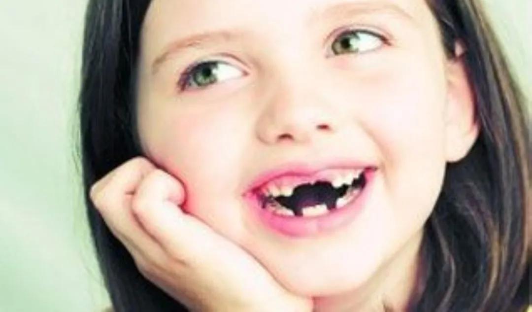 宝宝才三岁牙都坏了咋办,宝宝快三岁了牙齿才16颗