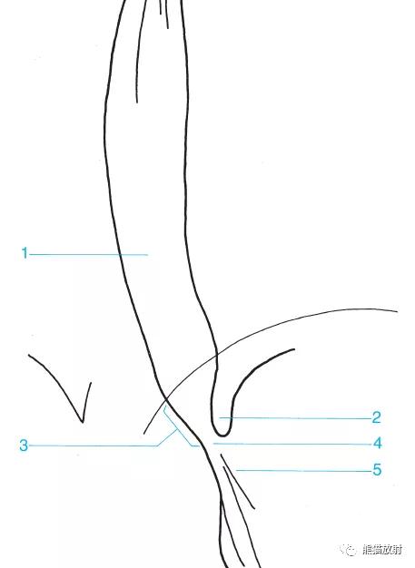 详细的消化道造影+彩色解剖图