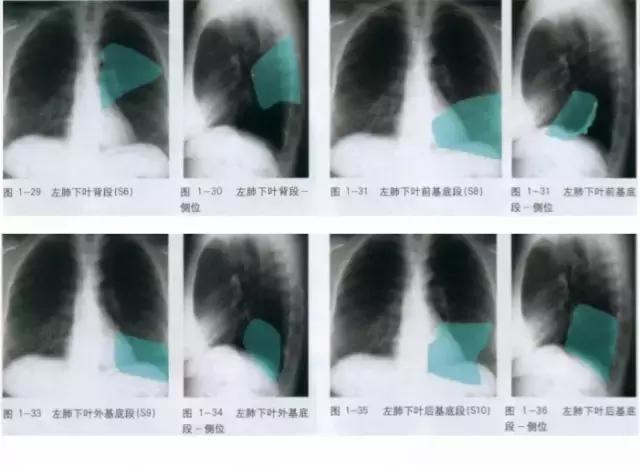 休闲小白鞋夏,献血小板相当于献血多少