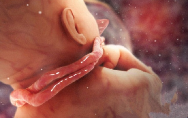 怀孕最怕脐带打结,孕期最怕胎儿脐带绕颈怎么避免