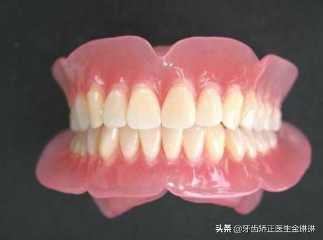 虎牙齿怎么矫正,有老虎牙怎么办