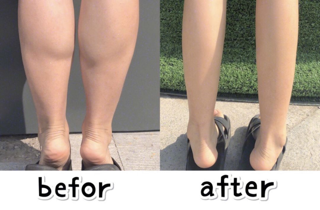 郑爽同款漫画腿不动刀也能get？吴昕的萝卜腿有救了