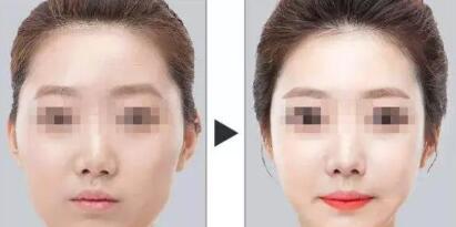 太阳穴凹陷颧弓外扩怎么画眉毛,太阳穴凹陷颧弓突出明显怎么化妆