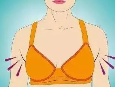 副乳是癌前兆？9102年了，别再被忽悠了