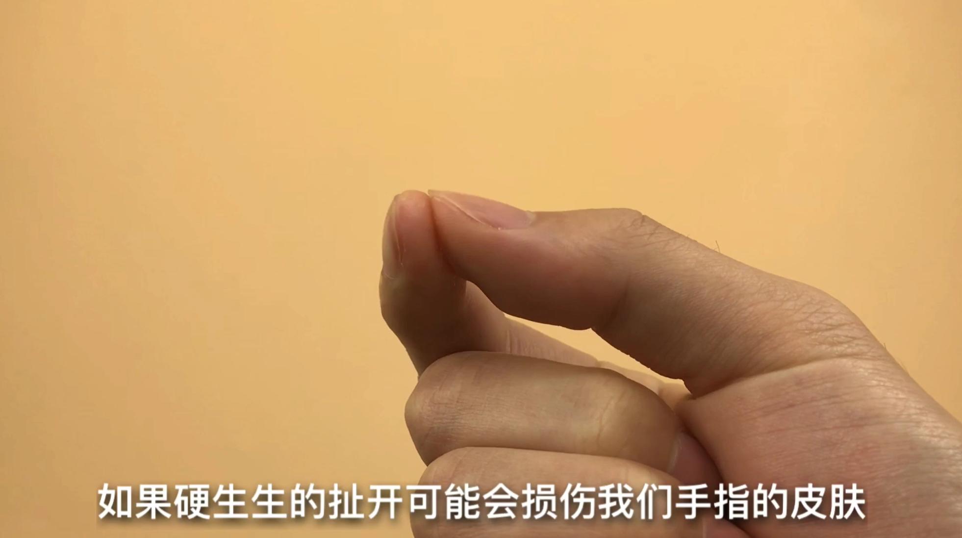 手指粘了502很久都好不了怎么办,502把手指和木棍粘在一起怎么办